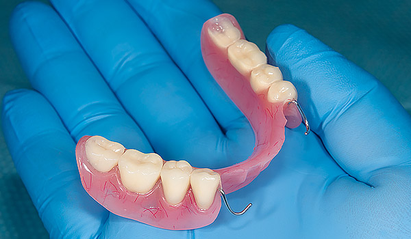 estrada-dentures-3