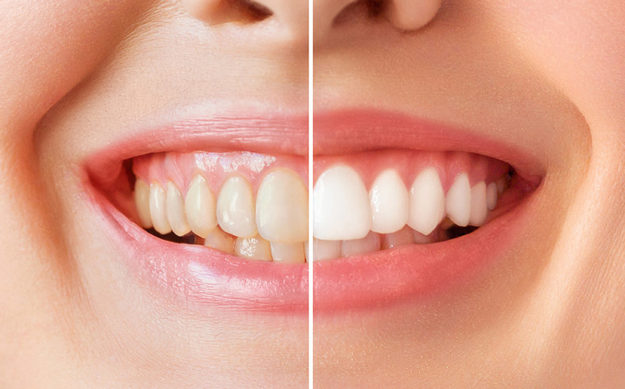 estrada-whitening-hero-v1