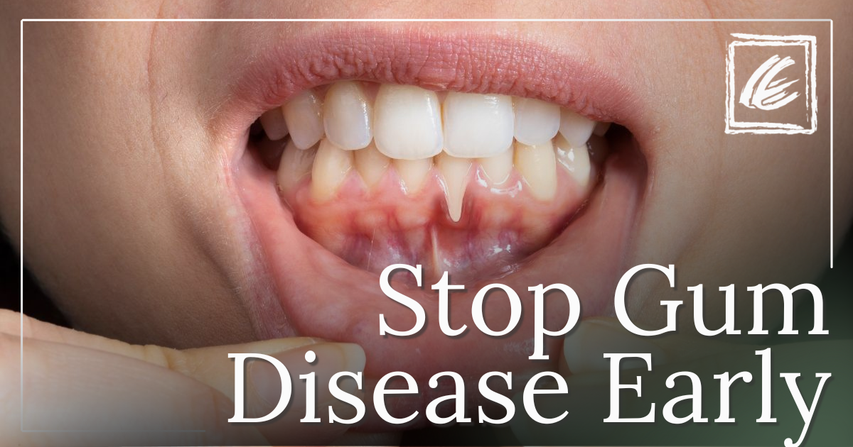 Estrada Email March 2026